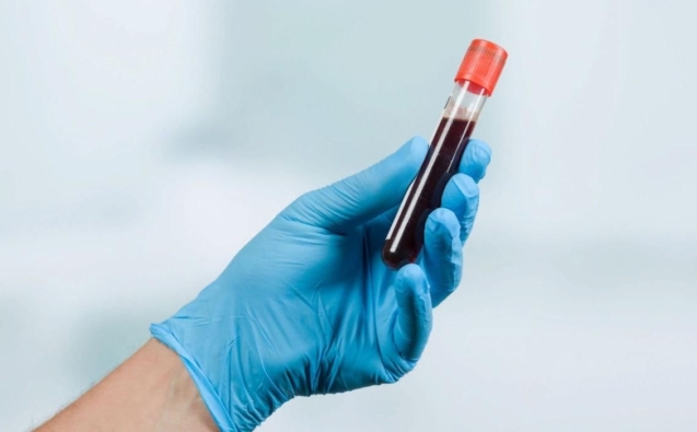 Plasma rico en plaquetas